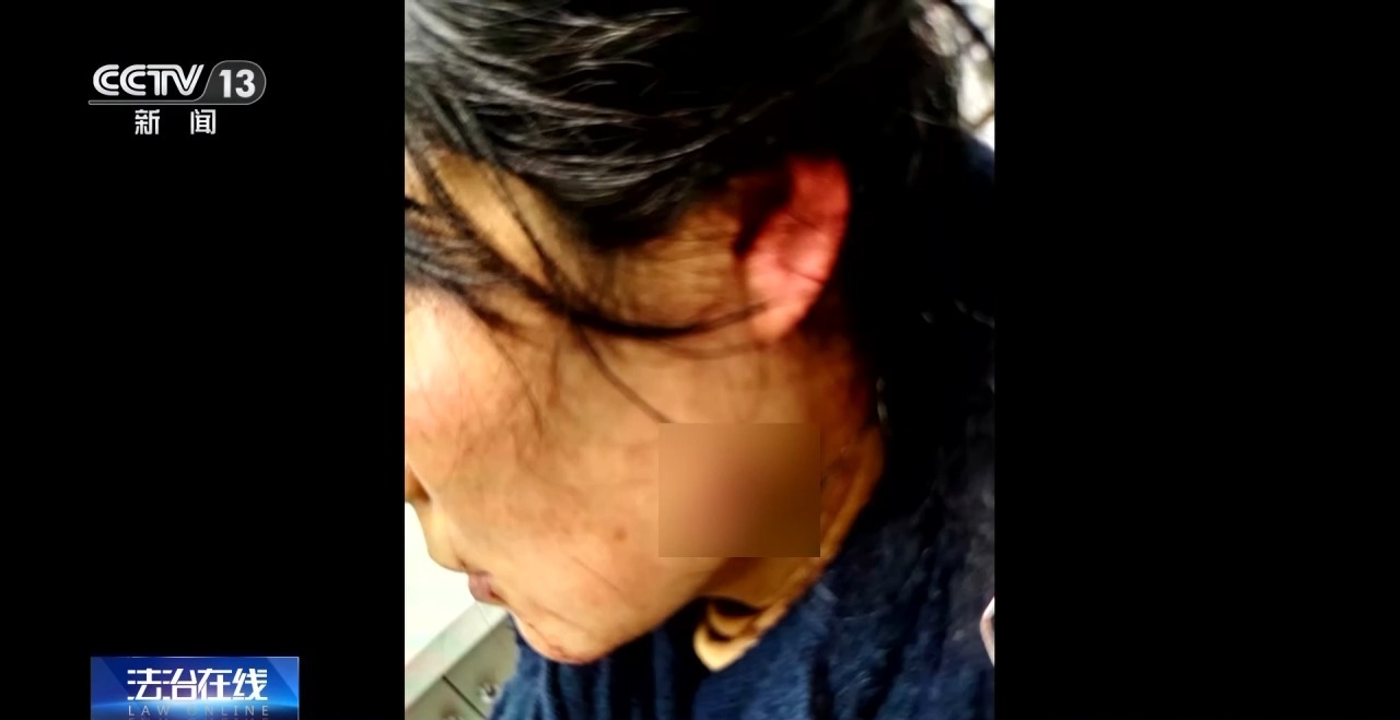 央媒观豫 | 5厘米伤口紧邻颈动脉 女警夺刀制凶：后怕但不后悔